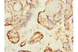 Immunohistochemistry of paraffin-embedded human placenta tissue using ABIN7147657 at dilution of 1:100 (GCM1 antibody  (AA 207-436))