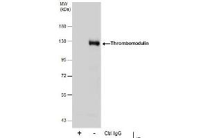 IP Image Immunoprecipitation of Thrombomodulin protein from THP-1 whole cell extracts using 5 μg of Thrombomodulin antibody [C3], C-term, Western blot analysis was performed using Thrombomodulin antibody [C3], C-term, EasyBlot anti-Rabbit IgG  was used as a secondary reagent.