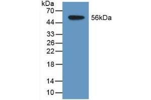 Detection of Recombinant TDH, Human using Polyclonal Antibody to L-Threonine Dehydrogenase (TDH) (Tdh antibody  (AA 1-229))