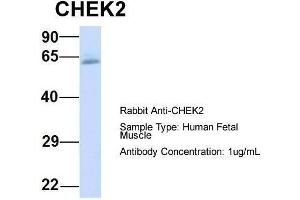 Host:  Rabbit  Target Name:  CHEK2  Sample Type:  Human Fetal Muscle  Antibody Dilution:  1. (CHEK2 antibody  (N-Term))