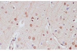 Immunohistochemistry of paraffin-embedded Rat brain using CREB1 Polyclonal Antibody at dilution of 1:100 (40x lens). (CREB1 antibody)