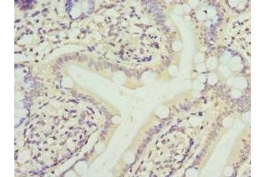 Immunohistochemistry of paraffin-embedded human small intestine tissue using ABIN7152793 at dilution of 1:100