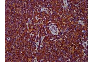 IHC image of ABIN7150062 diluted at 1:400 and staining in paraffin-embedded human lymph node tissue performed on a Leica BondTM system. (ADAM8 antibody  (AA 677-824))