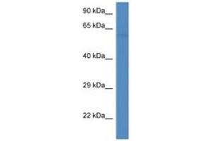 Image no. 1 for anti-6-phosphofructo-2-Kinase/fructose-2,6-Biphosphatase 2 (PFKFB2) (AA 336-385) antibody (ABIN6746455) (PFKFB2 antibody  (AA 336-385))