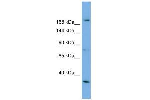 WB Suggested Anti-ALS2 Antibody Titration: 0.