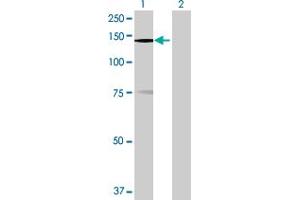 Western Blot analysis of MPHOSPH9 expression in transfected 293T cell line by MPHOSPH9 MaxPab polyclonal antibody. (MPHOSPH9 antibody  (AA 1-1031))