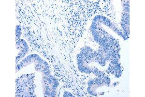 Immunohistochemistry (IHC) image for anti-Ciliary Neurotrophic Factor Receptor (CNTFR) antibody (ABIN1871941)