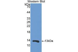Western blot analysis of the recombinant protein. (S100A11 antibody  (AA 1-102))