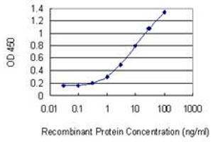 Detection limit for recombinant GST tagged SOD1 is 0. (SOD1 antibody  (AA 1-154))