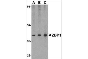 Western blot analysis of ZBP1 in mouse small intestine tissue lysate with ZBP1 antibody at (A) 0.