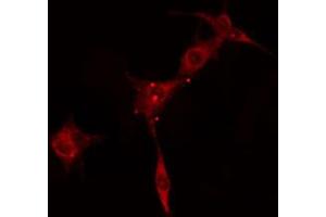 Immunofluorescence (fixed cells) (IF/ICC) image for anti-Protein Kinase, CAMP-Dependent, Regulatory, Type II, alpha (PRKAR2A) (N-Term) antibody (ABIN6259606)