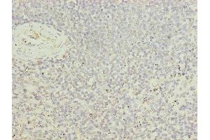 Immunohistochemistry of paraffin-embedded human spleen tissue using ABIN7174417 at dilution of 1:100 (UBASH3B antibody  (AA 1-300))