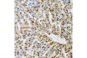Immunohistochemistry of paraffin-embedded Rat liver using TrkA antibody (ABIN7268895) at dilution of 1:100 (40x lens).