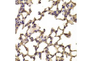 Immunohistochemistry of paraffin-embedded Mouse lung using TPP2 antibody at dilution of 1:100 (x400 lens). (Tpp2 antibody)