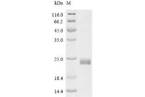 Tumor Necrosis Factor Receptor Superfamily, Member 10d, Decoy with Truncated Death Domain (TNFRSF10D) (AA 56-211) protein (His-SUMO Tag)