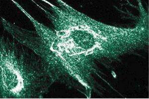 Immunofluorescence staining of human intestinal smooth muscle cells (HISM). (ANKS1B antibody  (AA 107-268))