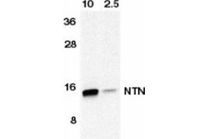 Image no. 1 for anti-Neurturin (NRTN) (AA 178-193) antibody (ABIN201348)