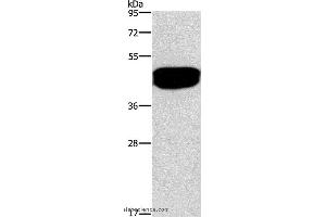 Western blot analysis of Human prostate tissue, using SDCCAG3 Polyclonal Antibody at dilution of 1:500 (SDCCAG3 antibody)