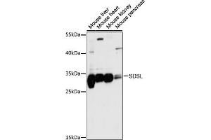 Western blot analysis of extracts of various cell lines, using SDSL antibody (ABIN7270209) at 1:1000 dilution. (SDSL antibody  (AA 1-137))