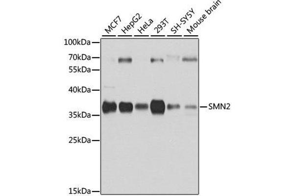 SMN2 antibody  (AA 1-197)