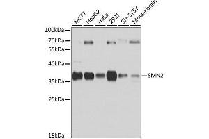 Western blot analysis of extracts of various cell lines, using SMN2 antibody. (SMN2 antibody  (AA 1-197))