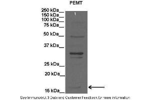 Lanes:   Lane1: 20 ug rat liver lysate  Primary Antibody Dilution:   1:2000  Secondary Antibody:   Anti-rabbit HRP  Secondary Antibody Dilution:   1:15000  Gene Name:   PEMT  Submitted by:   Anonymous (PEMT antibody  (C-Term))