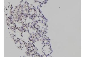 ABIN6277198 at 1/100 staining Mouse lung tissue by IHC-P.