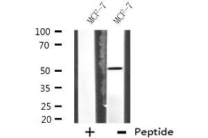 Western blot analysis of extracts from MCF-7 cells, using HUCE1 antibody. (RRP8 antibody  (Internal Region))