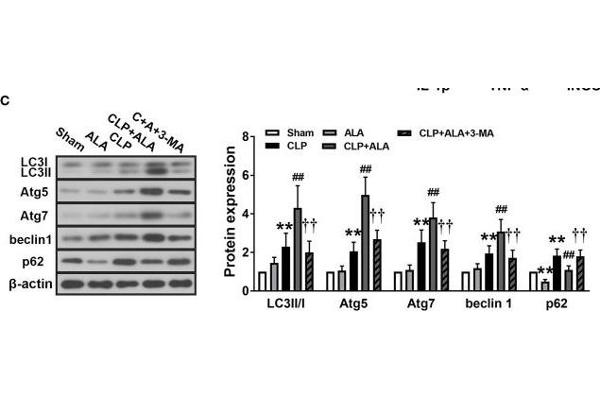 ATG5 antibody  (AA 1-275)