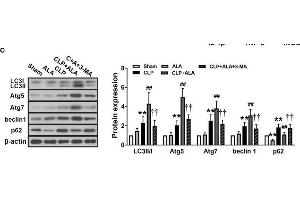 Effects of ALA on cardiac function, inflammation and autophagy in CLP-induced septic rats. (ATG5 antibody  (AA 1-275))