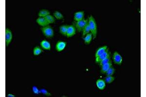 Immunofluorescent analysis of HepG2 cells using ABIN7158591 at dilution of 1:100 and Alexa Fluor 488-congugated AffiniPure Goat Anti-Rabbit IgG(H+L) (LHCGR antibody  (AA 27-363))