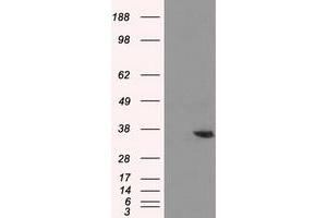 Western Blotting (WB) image for anti-Aldo-Keto Reductase Family 1, Member A1 (Aldehyde Reductase) (AKR1A1) antibody (ABIN1496539) (AKR1A1 antibody)