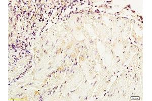 Formalin-fixed and paraffin embedded dog bladder tissue labeled with Anti-NSE/ENO2/γ Enolase Polyclonal Antibody, Unconjugated  at 1:800, followed by conjugation to the secondary antibody and DAB staining (ENO2/NSE antibody  (AA 201-300))