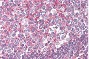 ABIN308439 (2. (Septin 2 antibody  (N-Term))