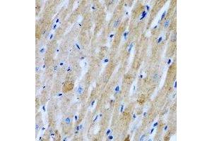 Immunohistochemical analysis of GlyRS staining in rat heart formalin fixed paraffin embedded tissue section. (GlyRS antibody)