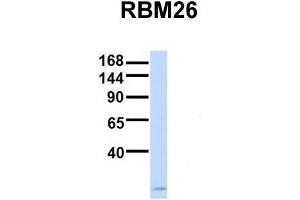 Host:  Rabbit  Target Name:  RBM26  Sample Type:  Human Fetal Brain  Antibody Dilution:  1. (RBM26 antibody  (Middle Region))