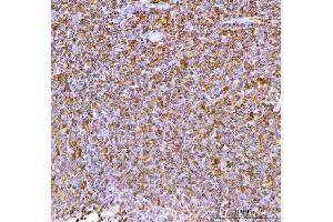 anti-Interleukin 34 (IL34) (AA 21-48) antibody