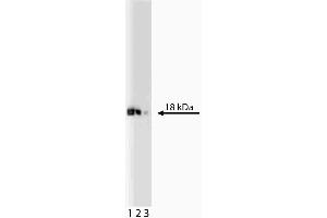 Western blot analysis of eIF-5a on a Jurkat lysate. (EIF5A antibody  (AA 58-154))