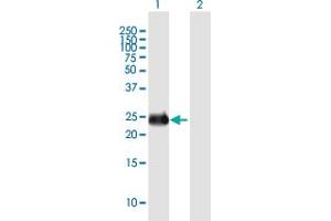 Western Blot analysis of INS-IGF2 expression in transfected 293T cell line by INS-IGF2 MaxPab polyclonal antibody.