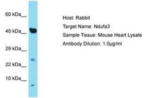 Image no. 1 for anti-NADH Dehydrogenase (Ubiquinone) 1 alpha Subcomplex, 3, 9kDa (NDUFA3) (C-Term) antibody (ABIN6749908) (NDUFA3 antibody  (C-Term))