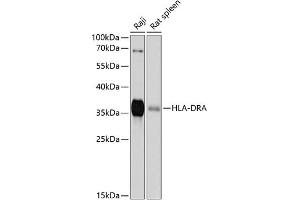Western blot analysis of extracts of various cell lines, using HLA-DRA antibody (ABIN6131757, ABIN6141827, ABIN6141829 and ABIN6215475) at 1:1000 dilution. (HLA-DRA antibody  (AA 26-216))