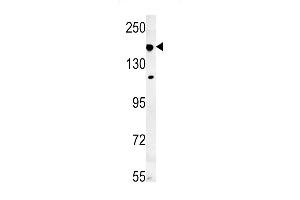 IF Antibody (N-term) (ABIN651581 and ABIN2840310) western blot analysis in mouse lung tissue lysates (35 μg/lane). (IFT172 antibody  (N-Term))