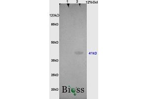 L1 rat brain, L2 , human colon carcinoma lysates probed (ABIN728773) at 1:200 in 4 °C. (OCT4 antibody  (AA 201-300))