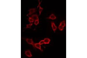 ABIN6274875 staining HeLa by IF/ICC. (ATP5C1 antibody  (Internal Region))