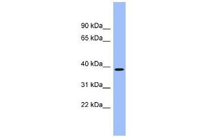 ACMSD antibody used at 1 ug/ml to detect target protein. (ACMSD antibody  (Middle Region))