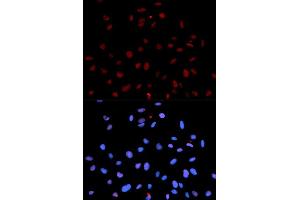 Immunofluorescence analysis of U2OS cells using Phospho-MET-Y1235 antibody (ABIN5969924). (c-MET antibody  (pTyr1235))