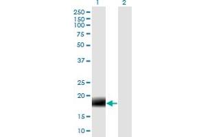 Western Blot analysis of 2-Mar expression in transfected 293T cell line by MARCH2 monoclonal antibody (M04), clone 7F3.