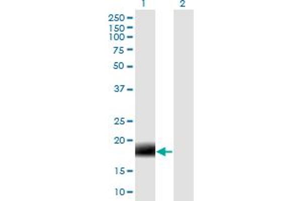 MARCH2 antibody  (AA 1-176)