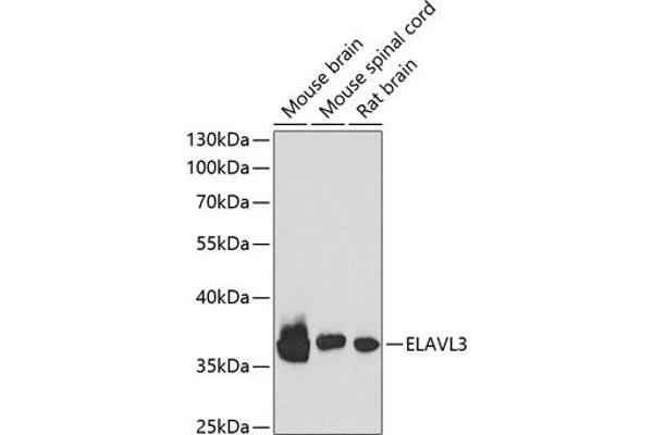 HuC/ELAVL3 antibody  (AA 1-100)
