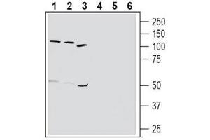 Western blot analysis of human K562 chronic myelogenous leukemia cell line lysate (lanes 1 and 4), human HL-60 promyelocytic leukemia cell line lysate (lanes 2 and 5) and human MEG-01 megakaryoblastic leukemia cell line lysate (lanes 3 and 6): - 1-3. (TBXA2R antibody  (Extracellular, N-Term))